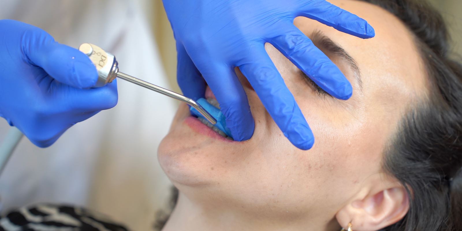 Merzifon ortodonti, suluova ortodonti kliniği, Taşova ortodonti kliniği, gümüşhacıköy ortodonti klinği, göynücek ortodonti kliniği, hamamözü ortodonti kliniği